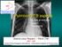 Pulmonary TB aspects