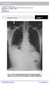 Case 1. A 35-year-old male presented with fever, cough, and purulent sputum for one week. This was his CXR (Fig. 1.1). What is the diagnosis?