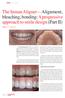 The Inman Aligner Alignment, bleaching, bonding: A progressive approach to smile design (Part II)