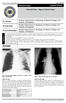 Medical Science. Research Paper. Pictorial View - Signs In Chest X-Rays