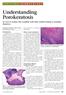 Understanding Porokeratosis