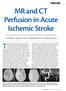 MR and CT Perfusion in Acute Ischemic Stroke The uses, methods, and risks associated with these alternative imaging modalities.