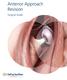 Anterior Approach Revision. Surgical Guide