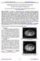 Clinicopathological study of primary renal primitive neuroectodermal tumor. Ruijin Zhou*, Tao Du, Zhonghua Liu, Xiangyang Wang