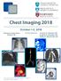 Chest Imaging October 1-3, Jo-Anne O. Shepard, MD Andetta R. Hunsaker, MD Subba R. Digumarthy, MD. Fairmont Copley Plaza Boston, MA