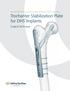 Trochanter Stabilization Plate for DHS Implants