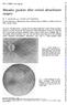 surgery Macular puckers after retinal detachment and loss of the macular reflex with a greyish appearance of the macula