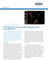 Application Note # MT-94 Direct Read-out of Thin Layer Chromatography (TLC) using MALDI-TOF