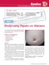 DERMCASE. Proliferating Papules on Abdomen. Case 1. 4.Small Lumps on the Lower Eyelids p.26 5.A Reddish,GrowingMass p.27 6.A WomanwithBackHair p.