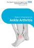 Ankle arthritis causes pain and stiffness of the ankle and has a major effect on quality of life. It affects up to 30,000 patients a year in the UK.