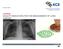 SYNTHESIS QUALITY INDICATORS FOR THE MANAGEMENT OF LUNG CANCER