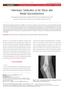 Heterotopic Ossification of the Elbow after Medial Epicondylectomy