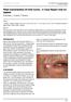 Field Cancerization Of Oral Cavity - A Case Report And An Update