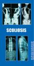 Cervical Plating Lumbar Microdiscectomy SCOLIOSIS
