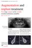 Augmentation and implant treatment Two-stage surgery in the severely resorbed edentulous mandible