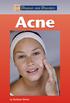 Diseases and Disorders. Acne. by Barbara Sheen. San Diego Detroit New York San Francisco Cleveland New Haven, Conn. Waterville, Maine London Munich