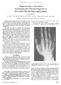 Angiosarcoma of the Hand Associated with Chronic Exposure to Polyvinyl Chloride Pipes and Cement