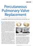 Percutaneous Pulmonary Valve Replacement