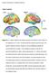 Figure S1: P maps of differences between groups in thickness of gray matter for. the subgroup of 16 Pure Tourette syndrome subjects and their age and