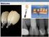 Implant Abutments and Crowns on your CEREC. Welcome