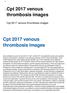 Cpt 2017 venous thrombosis images Cpt 2017 venous thrombosis images