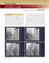 Challenging of contrast agent-free endovascular treatment using 3D imaging