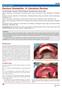 Denture Stomatitis: A Literature Review