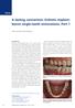A lasting connection: Esthetic implantborne single-tooth restorations. Part 1