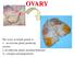 OVARY The surface of the ovary is covered with surface epithelium