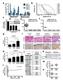 Supplementary Figure 1: Digitoxin induces apoptosis in primary human melanoma cells but not in normal melanocytes, which express lower levels of the
