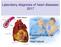 Laboratory diagnosis of heart diseases: Cardiometabolic risk AMI Heart failure
