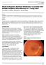 Bilateral Idiopathic Epiretinal Membranes Associated With Multiple Peripheral Neurofibromas In A Young Adult