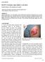 Post BCG vaccination Lupus vulgaris: A case report