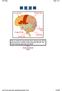 The Brain   Page 1 of 1 3/28/00 Slide #1 (BASIC) This is a model of a typical human brain, showing some o