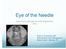 Eye of the Needle Interventional Management of the Degenerative Spine Brian A. Rosenberg, MD Interventional Pain Management Bone & Joint - Wausau, WI
