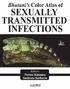 Bhutani s Color Atlas of SEXUALLY TRANSMITTED INFECTIONS. Second Edition. Editors. Neena Khanna MD