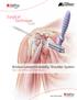 Surgical Technique. Guide. Bristow-Latarjet Instability Shoulder System Open and Arthroscopic Techniques