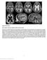 Nature Genetics: doi: /ng Supplementary Figure 1. Brain magnetic resonance imaging in patient 9 at age 3.6 years.