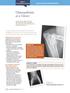 Osteoarthritis. at a Glance STEP 2