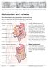 Malrotation and volvulus
