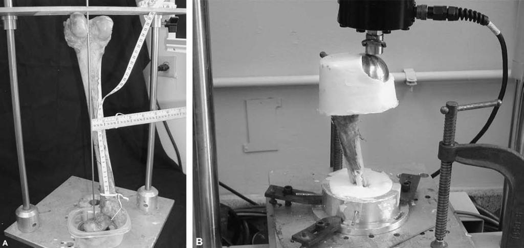 304 Oakey et al Clinical Orthopaedics and Related Research Fig 3A B. (A) The specimen is aligned along the mechanical axis. (B) This photograph shows a specimen in the MTS machine.