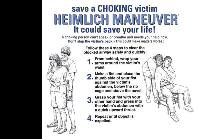 CONNECTION The Heimlich maneuver can save lives The Heimlich