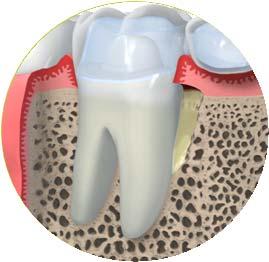 2011. 3 Straumann serves three dental specialty segments.