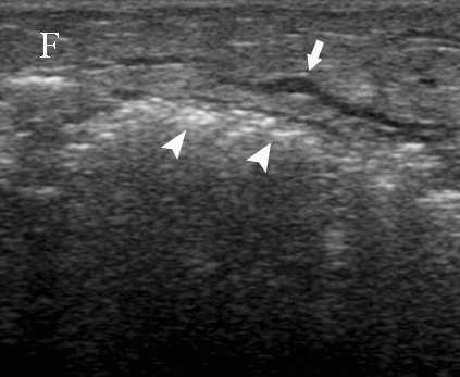 Page of Journal of Clinical Ultrasound 0 Fig.