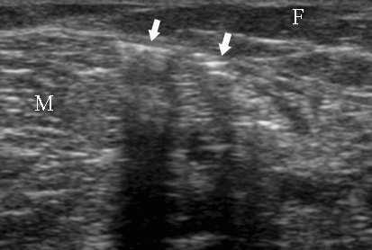 Journal of Clinical Ultrasound Page of 0 Fig.