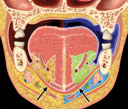 hypoglossus (XII) submandibulaarnäärme süvaosa ja - juha Submandibulaarruum (punane nool)