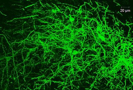 Silencing parvalbumin neurons