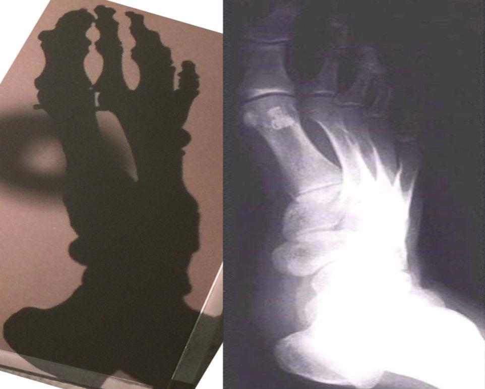 Radiography, by definition, is using the x-ray beam, and its ability or inability to penetrate different types of tissues to produce an image to aid in the diagnosis and treatment of injury or