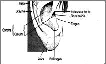 Ear Shape Root Helix: over folded or cupped