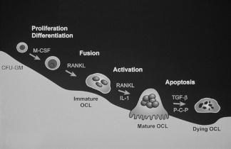 102 ANNALS NEW YORK ACADEMY OF SCIENCES FIGURE 1. Osteoclast life cycle from proliferation and differentiation to apoptosis. partially cure their osteopetrosis.